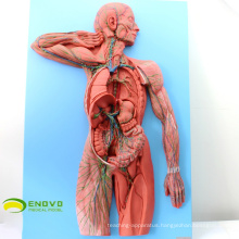 HEART13(12489 Human Lymphatic System Model for Hospital Patient Communication